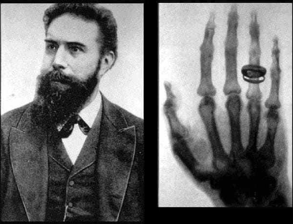 Wilhelm Conrad Roentgen, discoverer of X rays